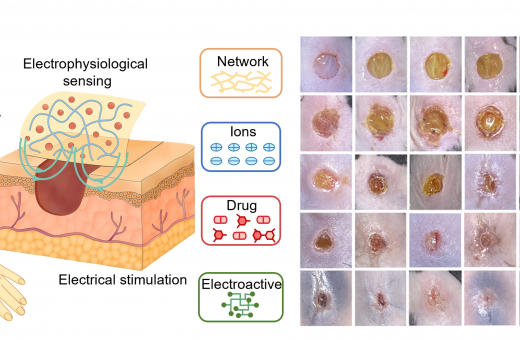 HKU Engineering Researchers Create Durable, Skin-Friendly Soft Materials for Next-Gen Wearable and Biomedical Devices